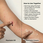 VedicDerm Sensitive Skin Bundle for Psoriasis, Eczema, Atopic Dermatitis | Grocsy