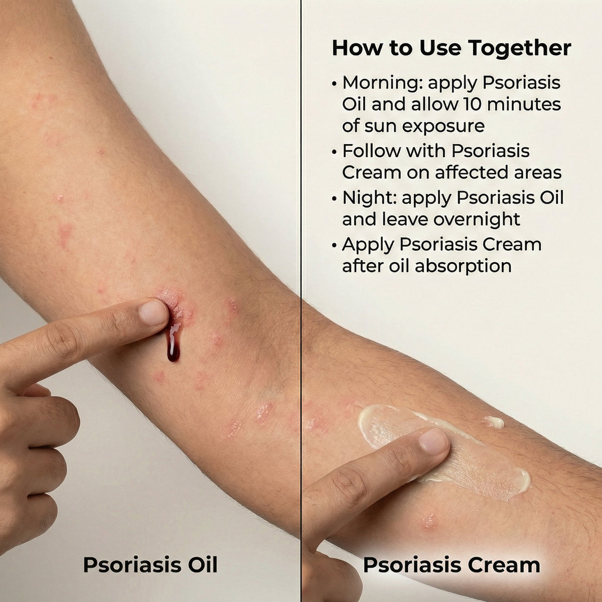 VedicDerm Sensitive Skin Bundle for Psoriasis, Eczema, Atopic Dermatitis | Grocsy