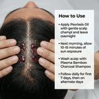 VedicDerm Sensitive Scalp Bundle for Psoriasis, Dandruff, & Itchy Scalp | Grocsy