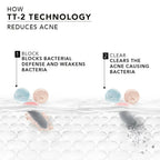Novology Acne Reduction Serum With 0.1% Thymol + Terpineol | Grocsy