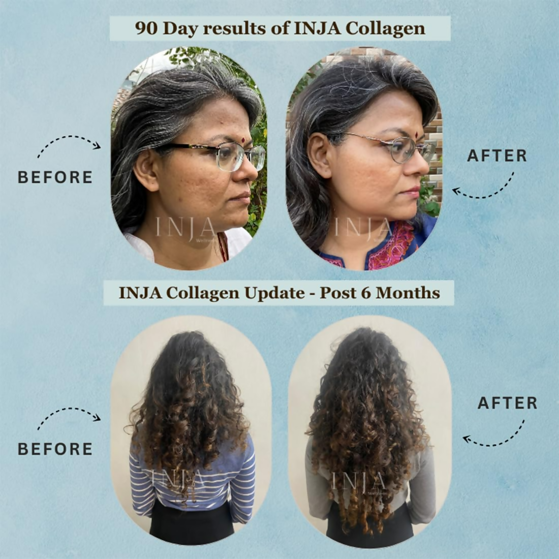 Inja Pro Marine Collagen Supplement For Women And Men For Healthy Skin | Grocsy