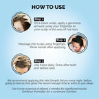 Prosoft Hair Therapy Serum For Hair Fall Control & Hair Growth | Grocsy