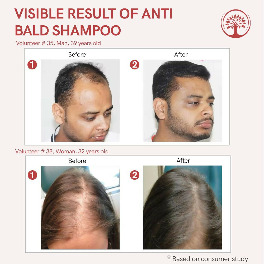 Ivory Natural Bald Shampoo Organic For Loss Of Hair And Get Fuller Thicker Hair | Grocsy