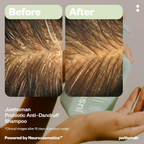 JustHuman Probiotic Anti Dandruff Shampoo | Grocsy