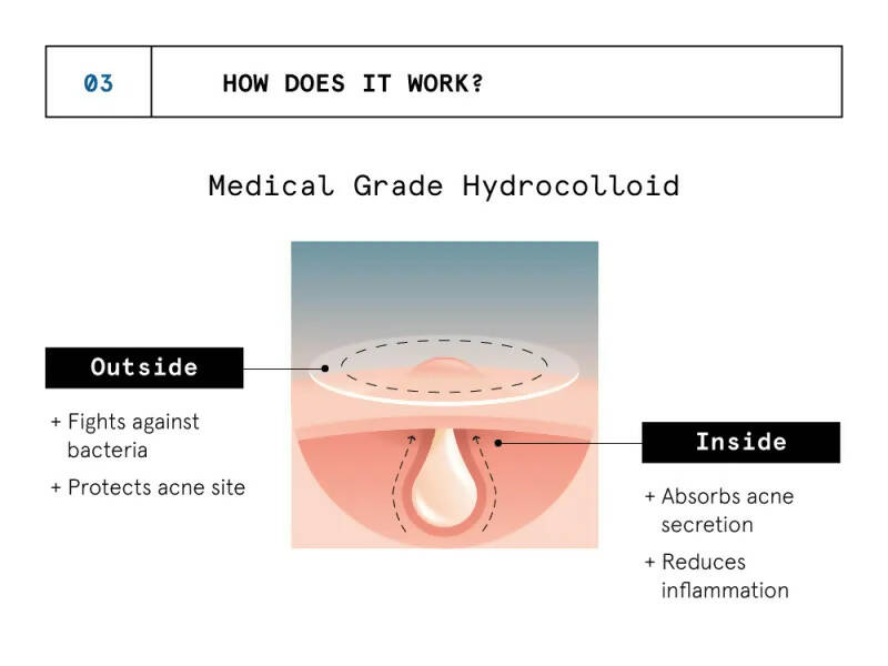 BeBodywise Hydrocolloid Acne Pimple Patch | Grocsy