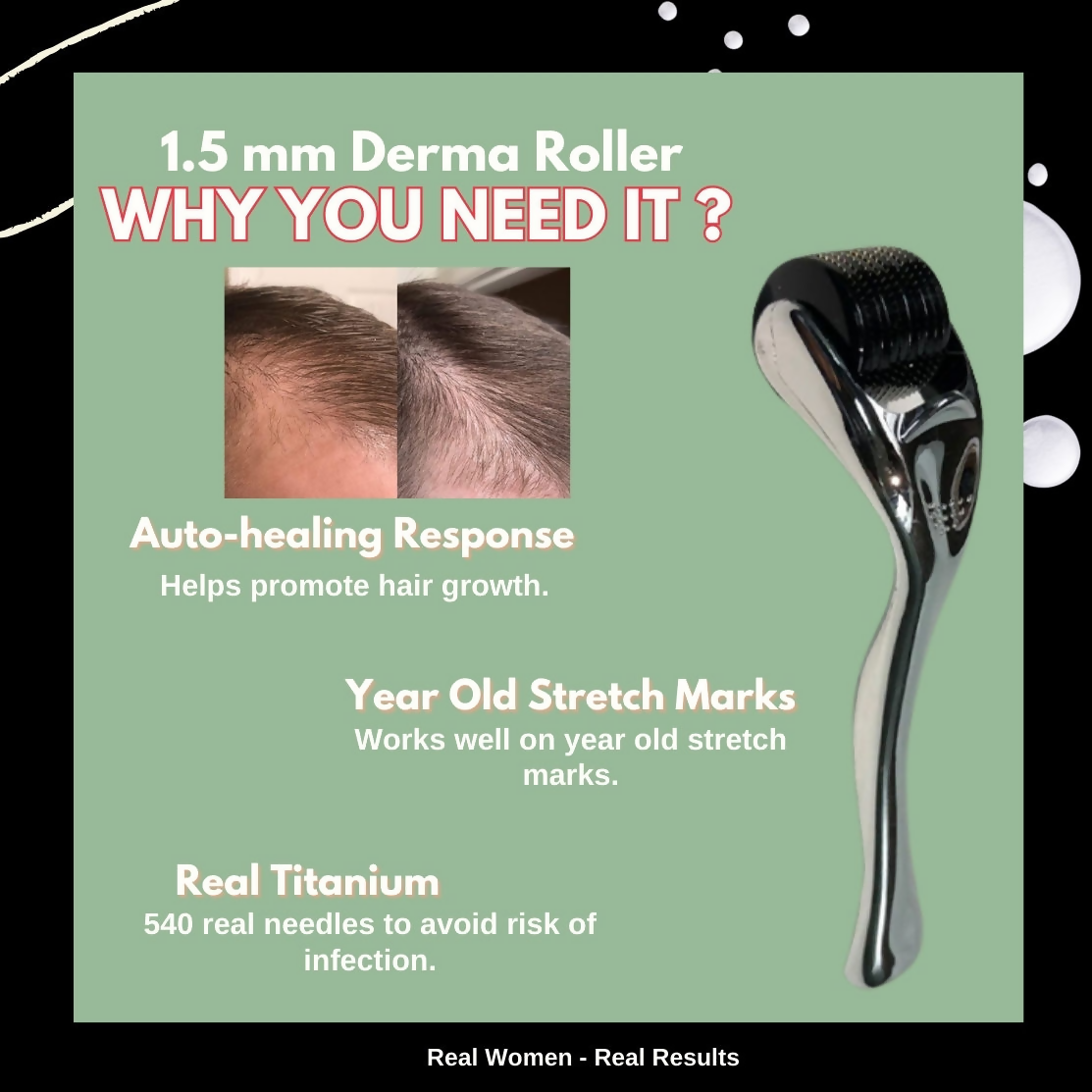 House of Beauty Derma Roller | Grocsy
