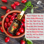 Beauty Secrets Certified Organic Rosehip Oil for Face and Body | Grocsy
