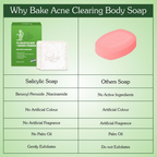 Bake 2% Salicylic Acid Soap for Face & Body Acne | Grocsy