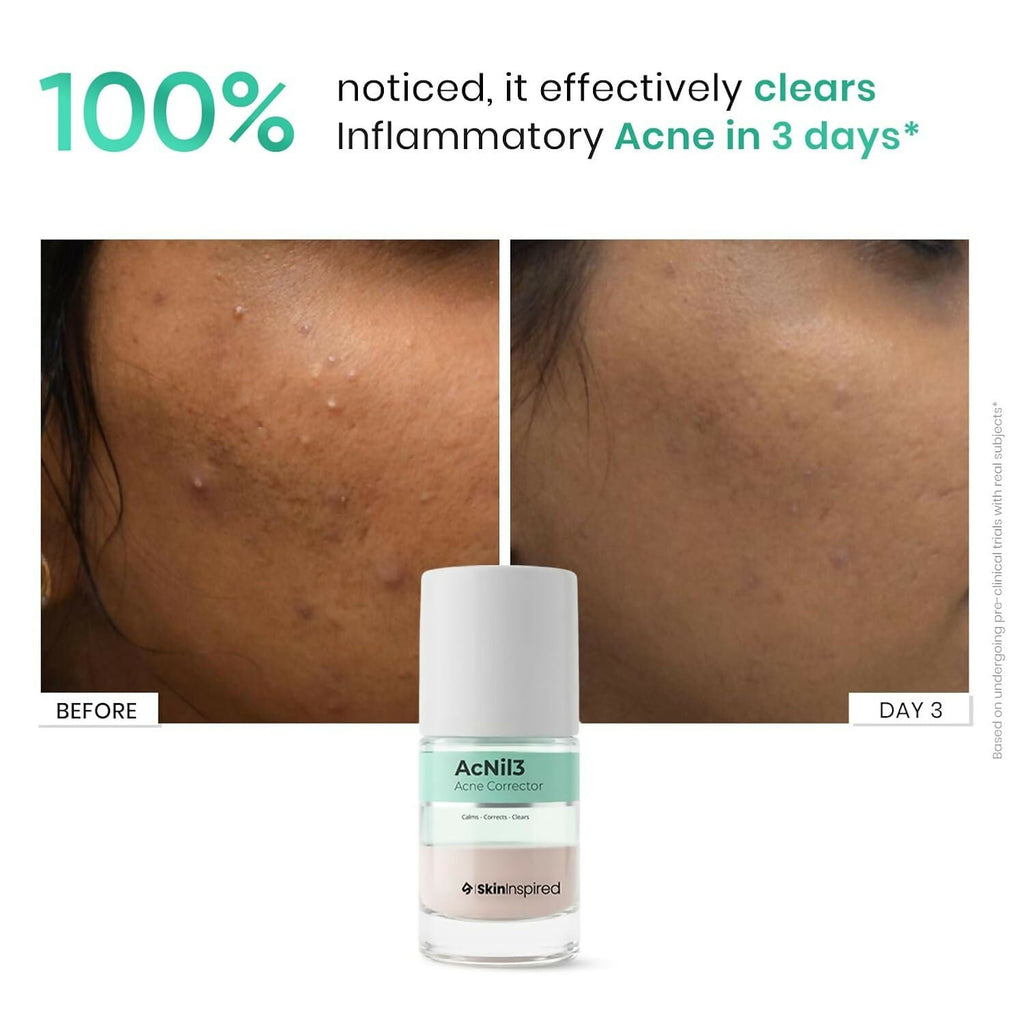 SkinInspired AcNil3 Rapid Spot Corrector | Grocsy