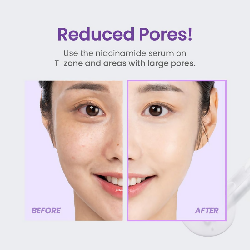 Tirtir Niacinamide 20% Serum | Grocsy