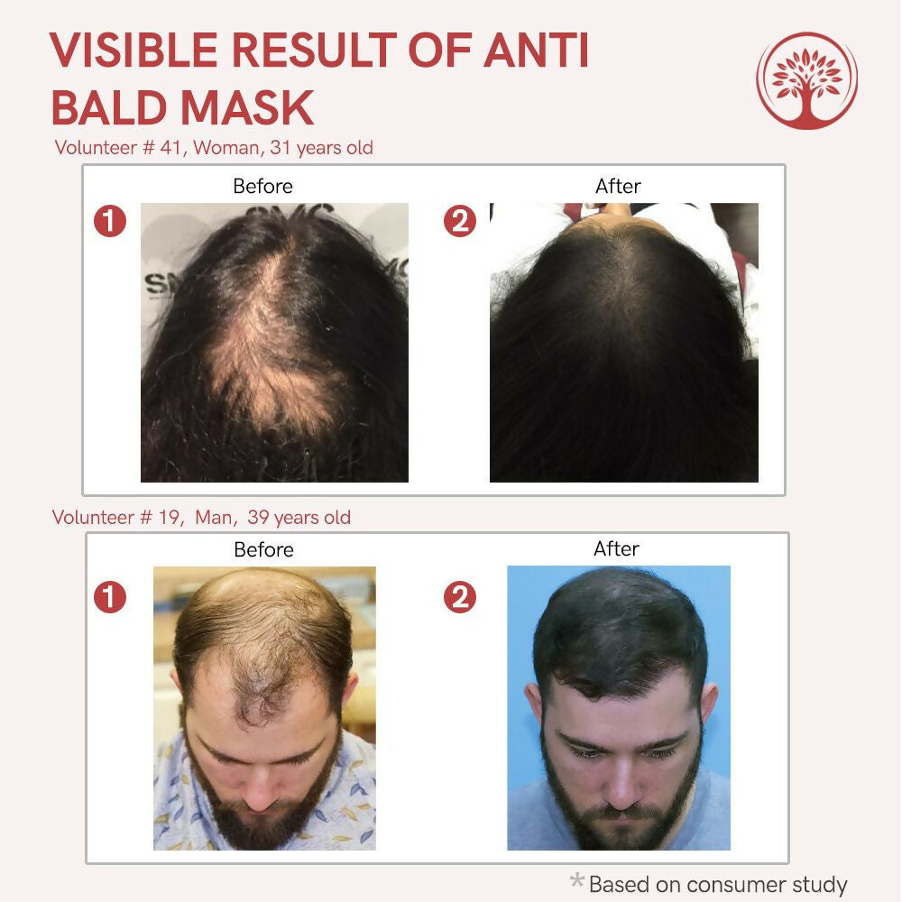 Ivory Natural Bald Mask For Hair - Hair Mask For Less Hair And Hair Thinning | Grocsy