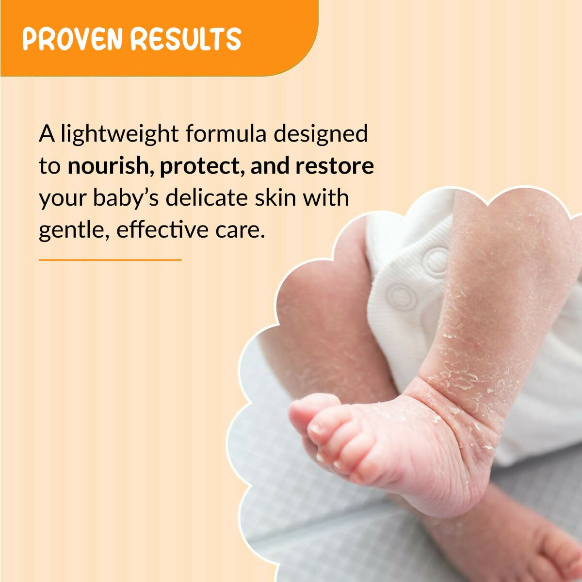 Fixderma Hoopoe Baby Moisturizing Lotion with 1% Ceramide | Grocsy