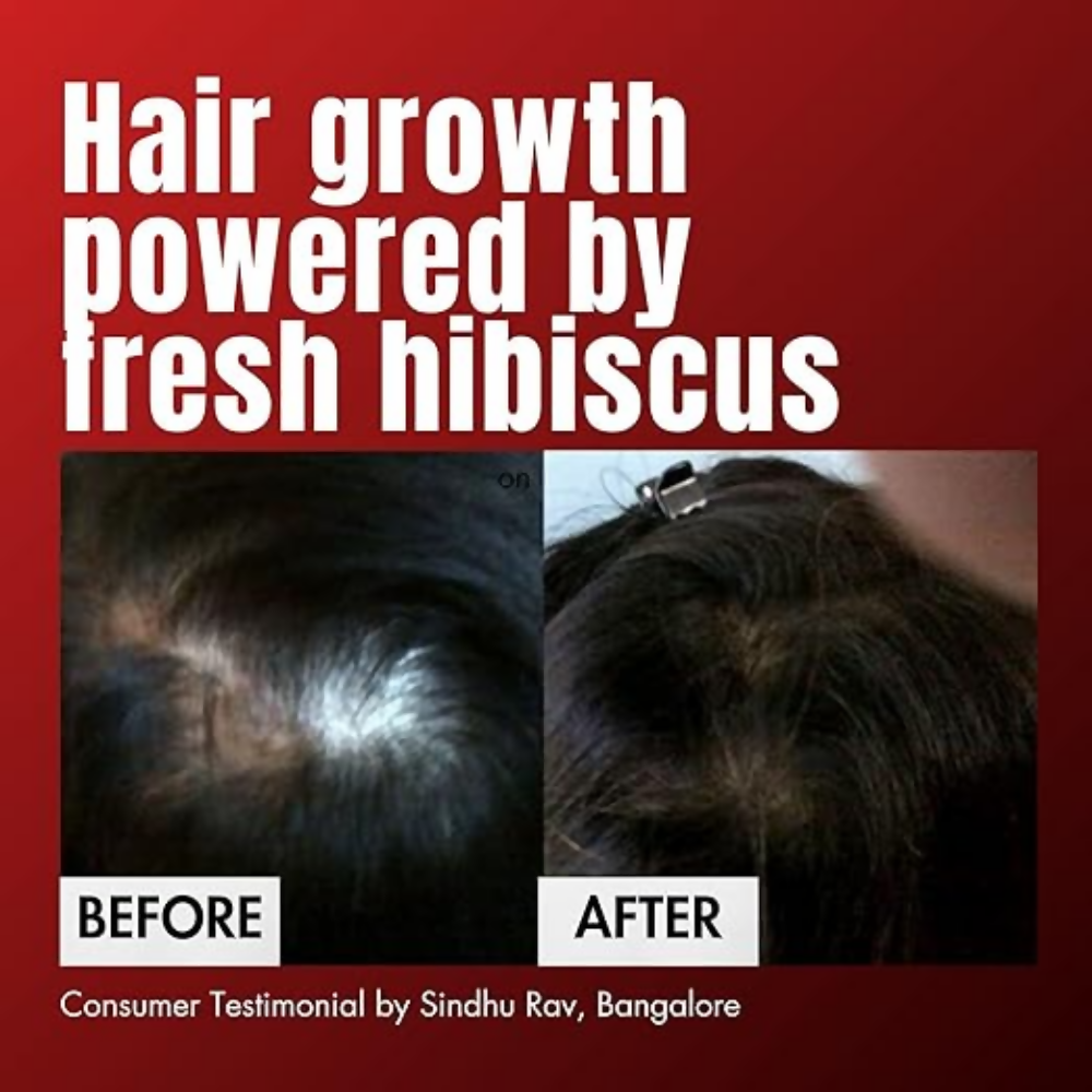 Hibiscus Monkey HM Love Scalp & Hair Oil | Grocsy