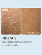 First Aid Beauty Ultra Repair Cream | Grocsy