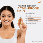 Himalaya Herbals Acne Clear+ Scar Removal Serum | Grocsy