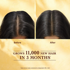 Indulekha Bringha Hair Growth Treatment Scalp Serum | Grocsy