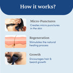 Man Matters Advance Derma Roller For Hair & Beard - 540 Micro 0.5mm Titanium Alloy Needles | Grocsy