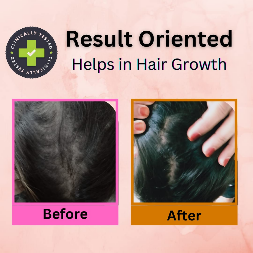 Curista Naturals Arnica Jaborandi Hair Growth Oil | Grocsy