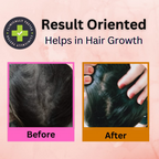 Curista Naturals Arnica Jaborandi Hair Growth Oil | Grocsy