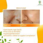 Adonis Adoclear Vitamin C Serum | Grocsy