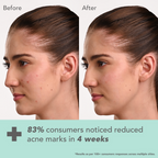 Lotus DermaBotanics Kojic acid + Multi Berry Face Serum | Grocsy