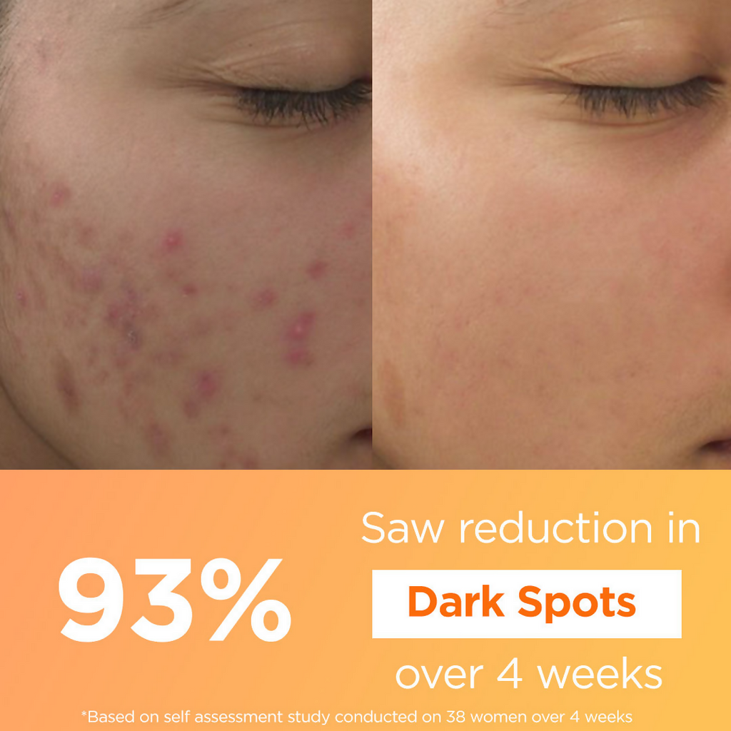 Light Up Thd Ascorbate Vitamin C Face Serum For Glowing Skin | Grocsy