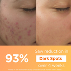 Light Up Thd Ascorbate Vitamin C Face Serum For Glowing Skin | Grocsy