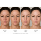 Frabia Retinol 0.1 Night Cream | Grocsy
