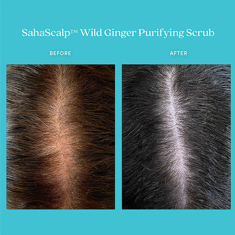 Fable & Mane Sahascalp Purifying Scrub To Gently Exfoliate Scalp With Wild Ginger&Pink Himalayan Salt | Grocsy
