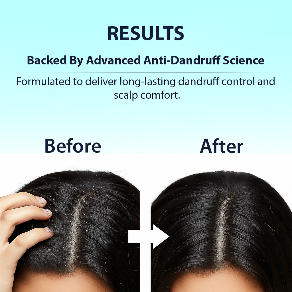 Dermistry Anti-Dandruff Control Shampoo Mask & Serum | Grocsy