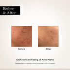 Milky Moon Face Glow Night Serum Dark Spot & Brightening Face Serum | Grocsy