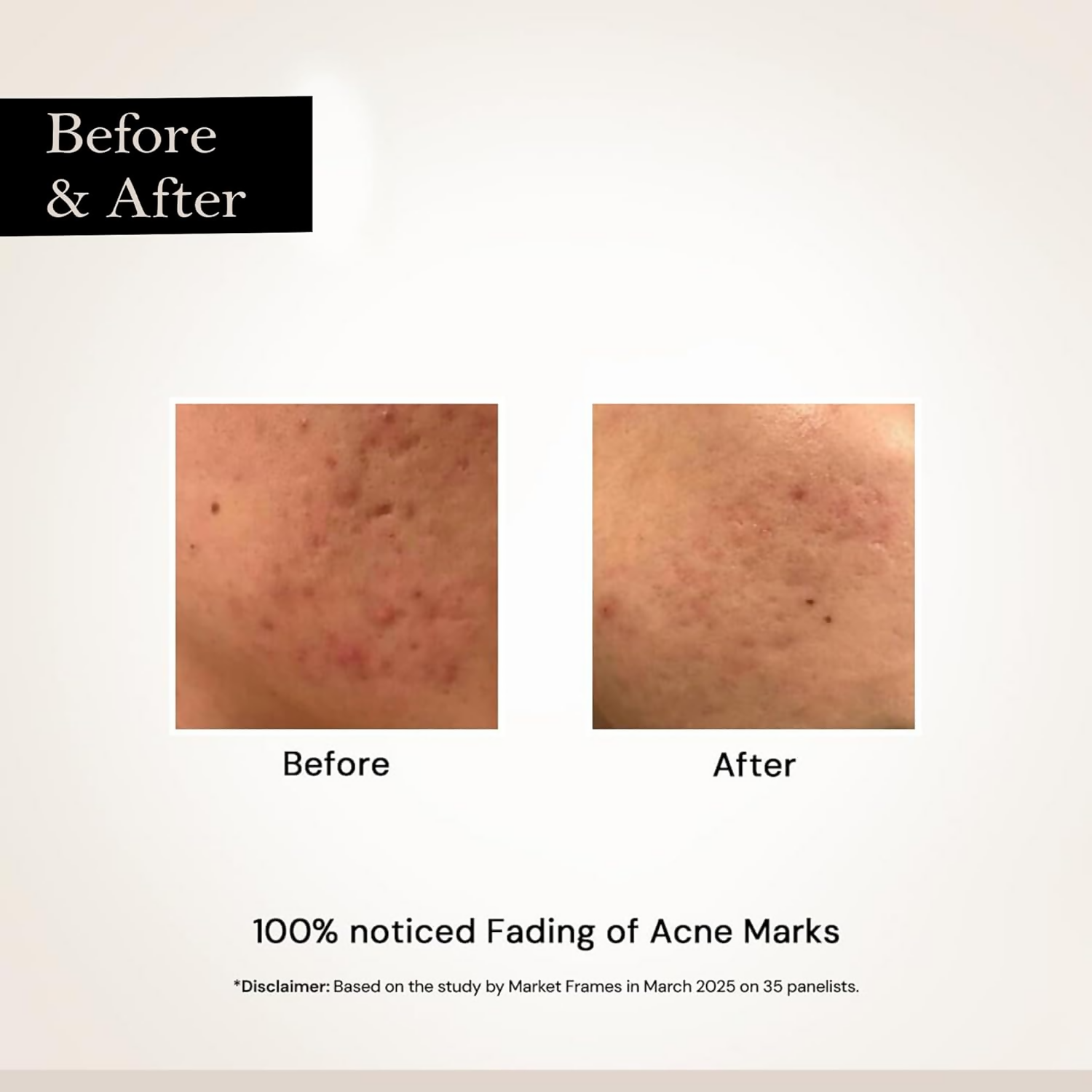 Milky Moon Face Glow Night Serum Dark Spot & Brightening Face Serum | Grocsy