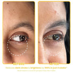 The Skin Diet Company Banana Brightening Under-Eye Cream - Dark Circles, Fine Lines with Niacinamide | Grocsy
