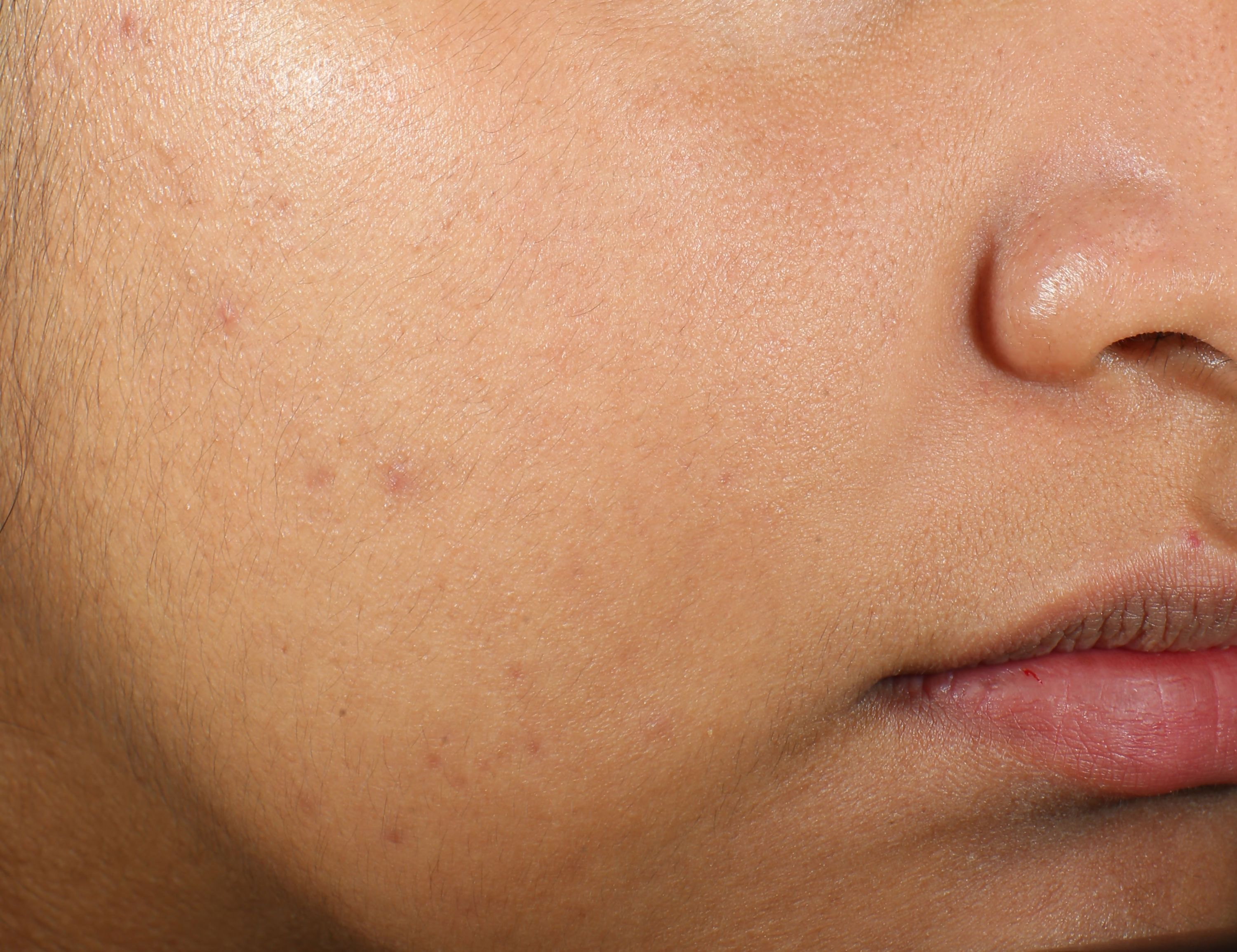Murad Clarifying Water Gel | Grocsy