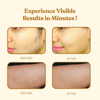 Wipness Natural Chocolate Facial Hair Removal Powder | Grocsy