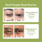 Vilvah Store Under Eye Cream (Dark Circle Control) | Grocsy