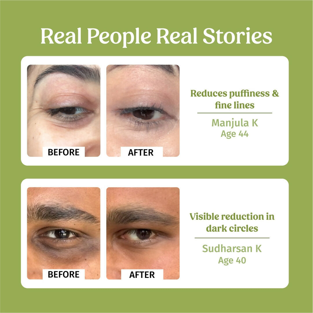 Vilvah Store Under Eye Cream (Dark Circle Control) | Grocsy