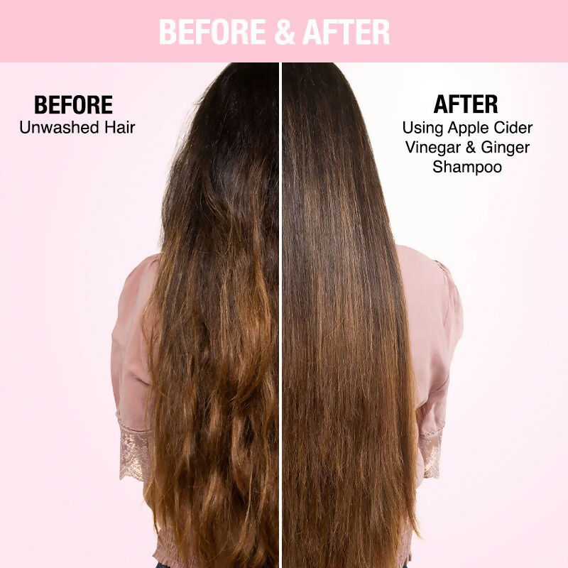 Nykaa Naturals Anti-Dandruff - Free Shampoo with Apple Cider Vinegar, Ginger & Tea Tree Oil | Grocsy