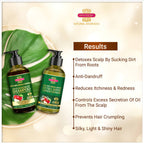 Inveda Anti Dandruff Expert Kit | Grocsy