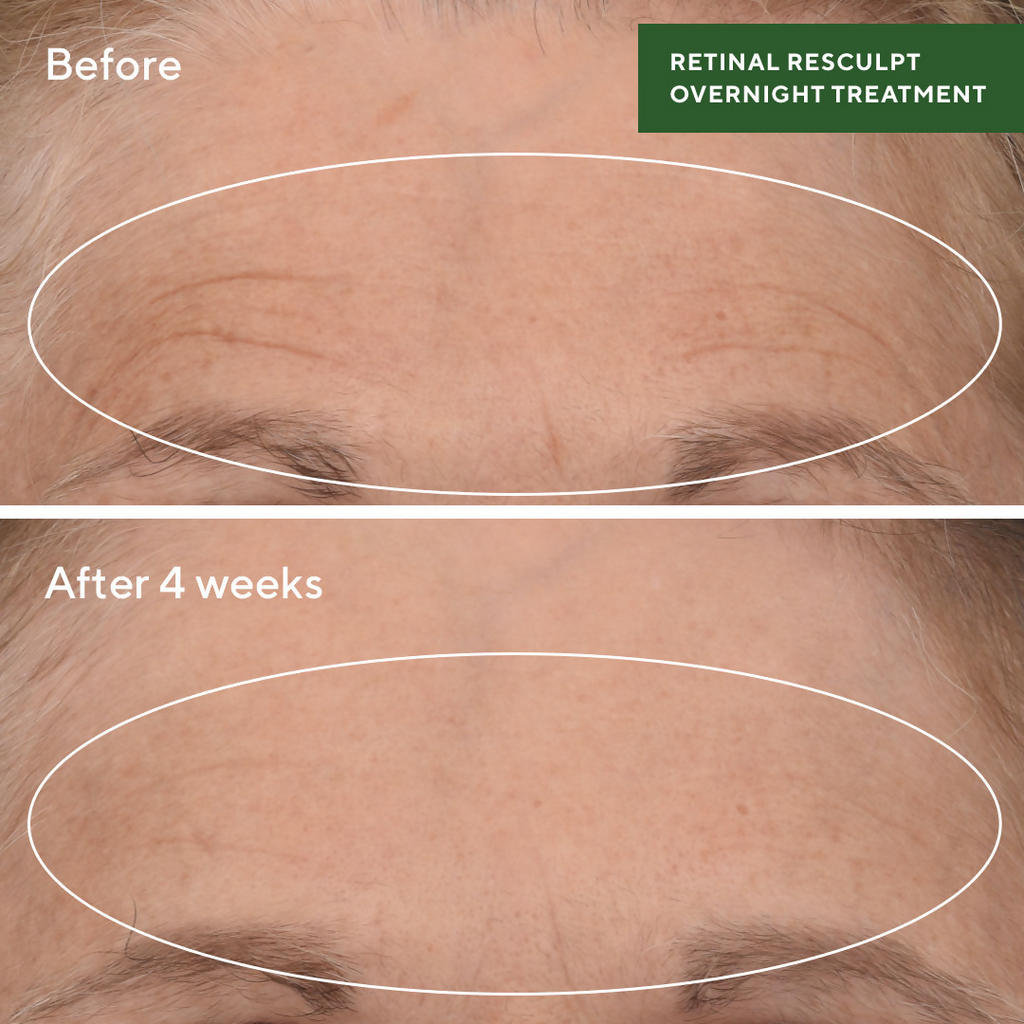 Murad Retinal ReSculpt Overnight Treatment | Grocsy
