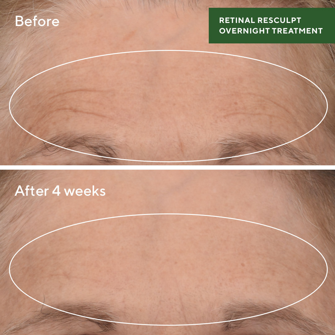 Murad Retinal ReSculpt Overnight Treatment | Grocsy