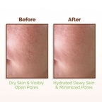 Mamaearth Rice Water Dewy Face Toner with 96% Pure Rice Water Extract & 4% Niacinamide for Glass Skin | Grocsy