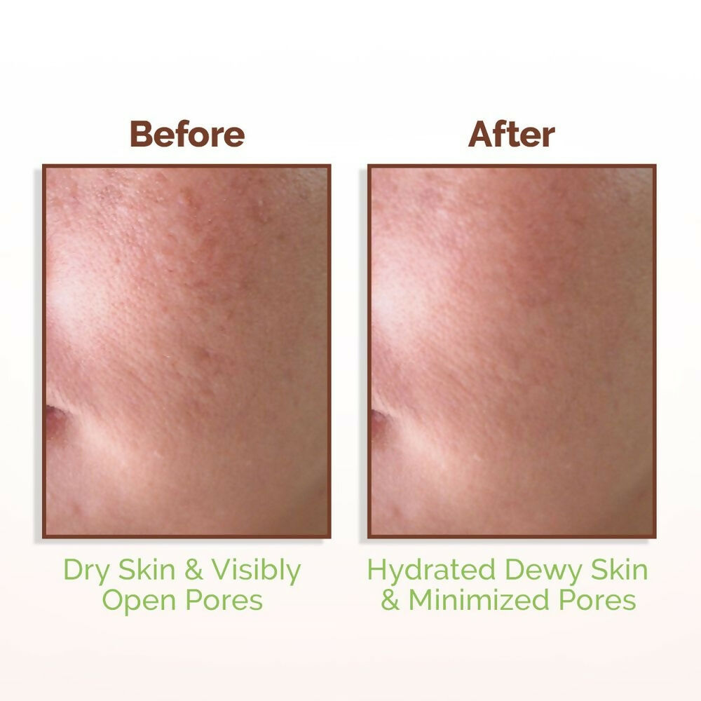 Mamaearth Rice Water Dewy Face Toner with 96% Pure Rice Water Extract & 4% Niacinamide for Glass Skin | Grocsy