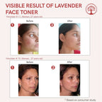 Ivory Natural Lavender Facial Toner For Acne, Even Skin Tone | Grocsy