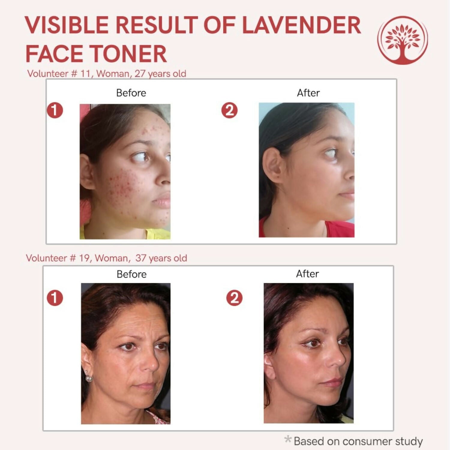 Ivory Natural Lavender Facial Toner For Acne, Even Skin Tone | Grocsy