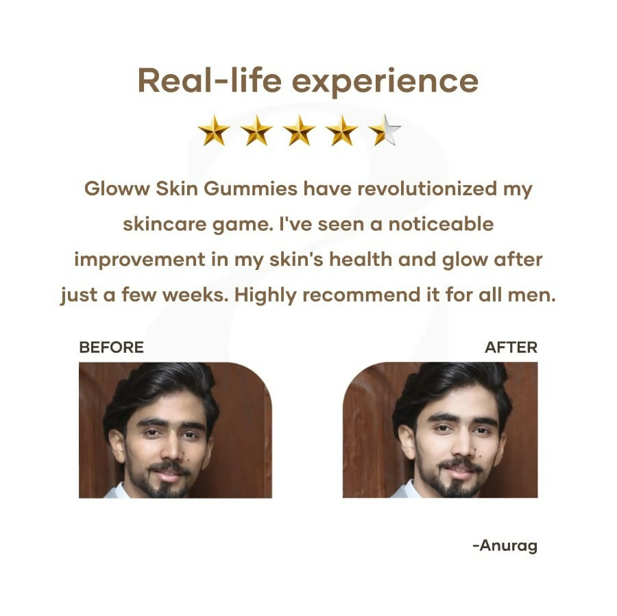 Mars By GHC Vitamin C Gloww Gummies | Grocsy