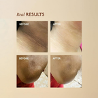 Asaya Tone Restore Advanced Pigmentation Cream with MelaMe Complex | Grocsy