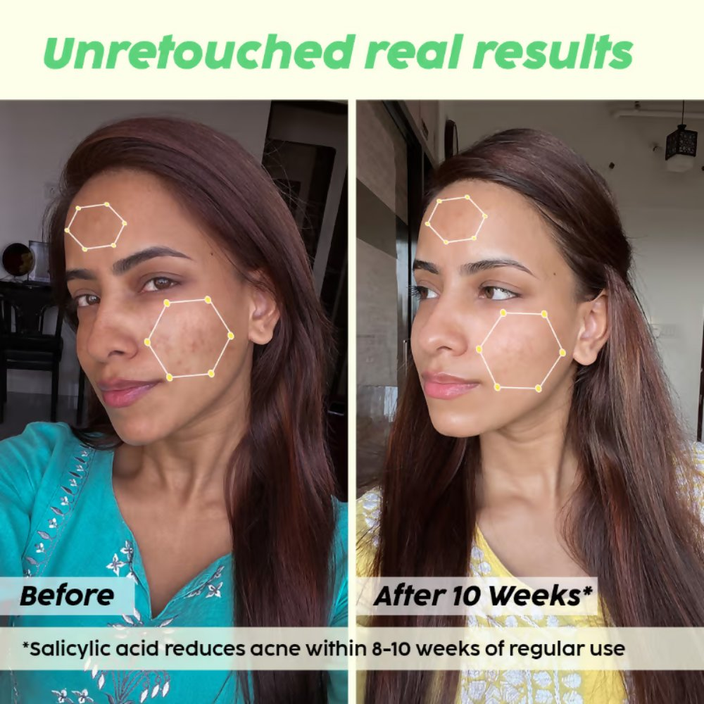 PLIX The Plant Fix 0.1% Salicylic Acid Mattifying Sunscreen SPF50+ PA+++ & Niacinamde Serum | Grocsy