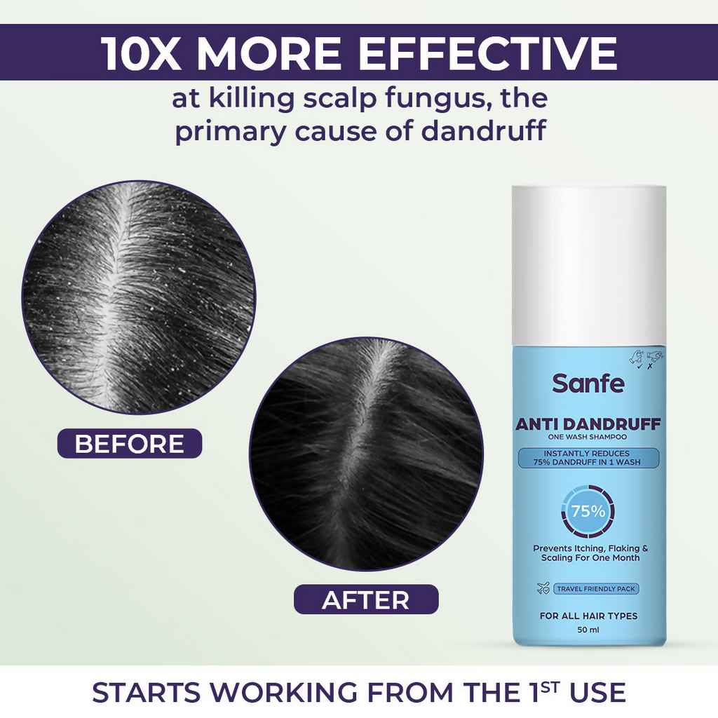 Sanfe Anti Dandruff One Wash Shampoo | Grocsy