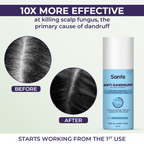 Sanfe Anti Dandruff One Wash Shampoo | Grocsy